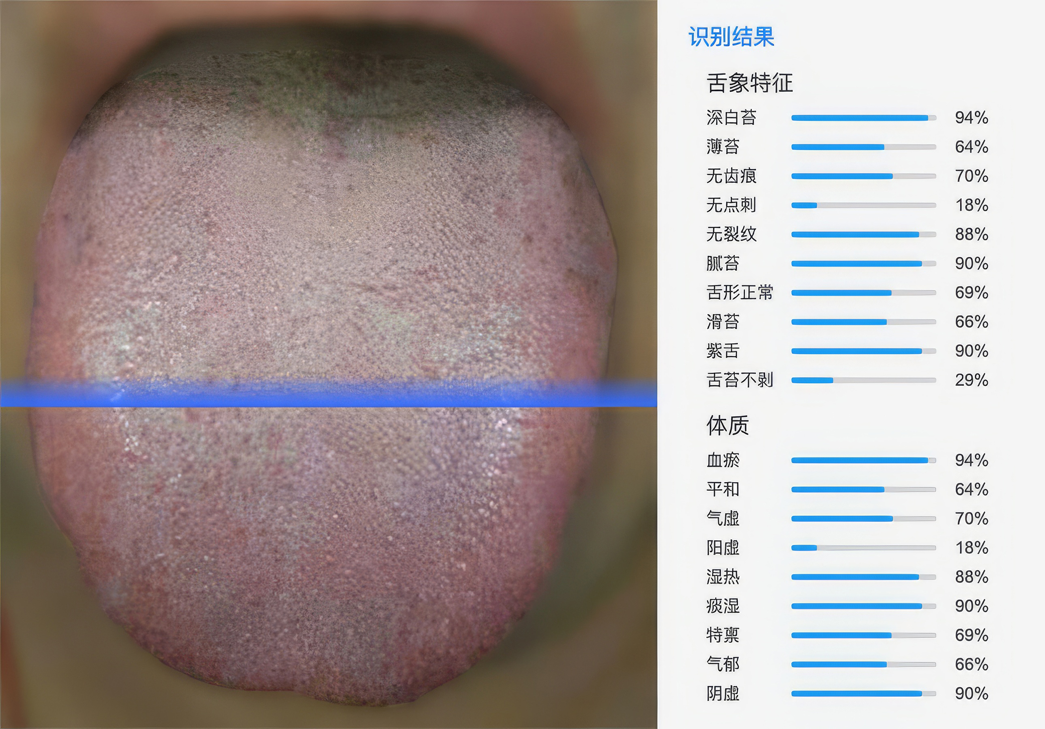 AI舌诊高级版 API 接口示意图